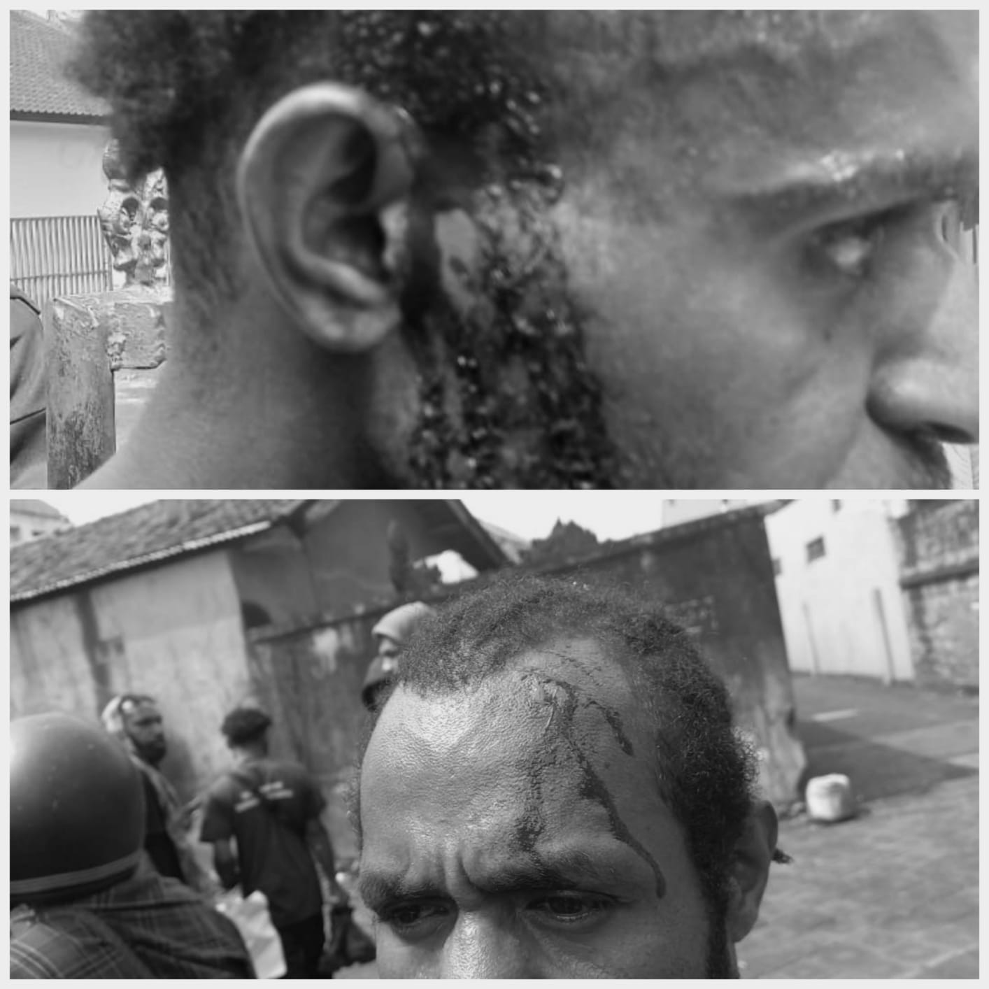 Kekerasan terhadap aksi damai mahasiswa Papua. Aksi damai Aliansi Mahasiswa Papua Komite Kota Bali (AMP KK Bali) kembali mengalami penghalangan oleh ormas reaksioner yang berujung kekerasan.